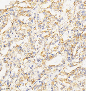 02  GB114564_20220908_USP15_12576_1257621081702 H kidney d800_IHC_30.0x.jpg