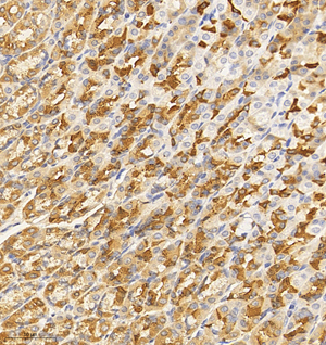 04  GB114564_20220908_USP15_12576_1257621081702 R stomach d800_IHC_30.0x.jpg
