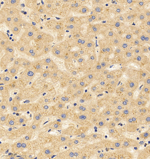 02  GB114697_20220908_PIP5KL1_12507_1250721081002 H liver d1000_IHC_30.0x.jpg