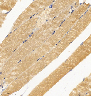 03  GB114697_20220908_PIP5KL1_12507_1250721081002 M skeletal muscle d1000_IHC_30.0x.jpg