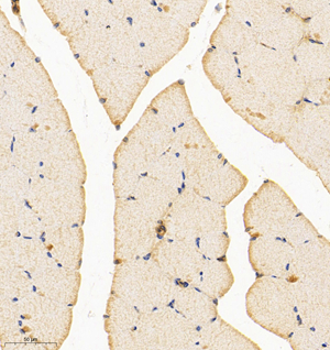 04  GB114697_20220908_PIP5KL1_12507_1250721081002 R skeletal muscle d1000_IHC_30.0x.jpg