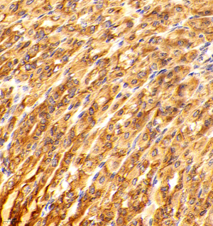 02 GB114527_20220722_VAPA_12499_1249921081002 M stomach d2400_40.0x_IHC.jpg