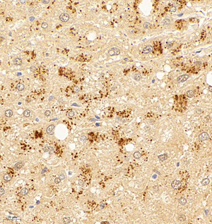 01 GB114617_20220811_NFS1_12661_1266121091302 H liver d900_40.0x_IHC.jpg