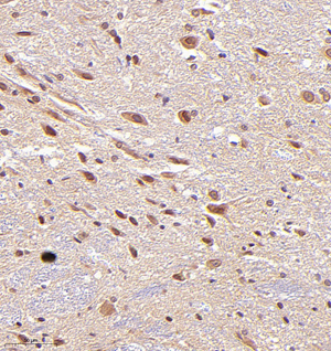 01 GB114683_20220819_RPA1_12804_1280421092002 R spinal cord d500_IHC_30.0x.jpg