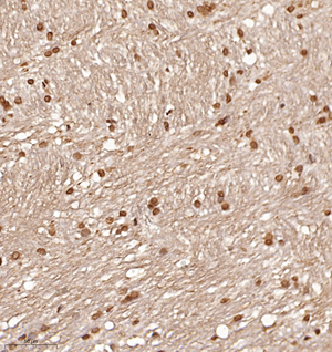 02 GB114804_20220908_RING2_12962_1296220102602 R Brain d1000_IHC_30.0x.jpg