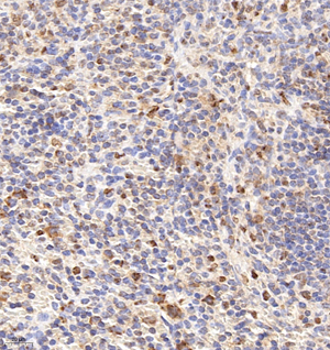 01 GB114810_20220908_CRHBP_12972_1297220102602 M model of antigen stimulation spleen d1000_IHC_40.0x.jpg