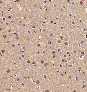 01 GB114821_20220908_NOVA1_12990_1299021102602 R brain d1000_IHC_30.0x.jpg