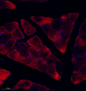 03 GB114847_CASQ2_12931_1293121101902 M skeletal muscle_d300_30.0x_IF.jpg