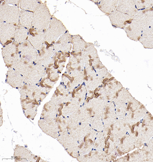 02 GB114917_20221010_BCS1L_13171_1317122032202 R skeletal muscle d800_30.0x_IHC.jpg