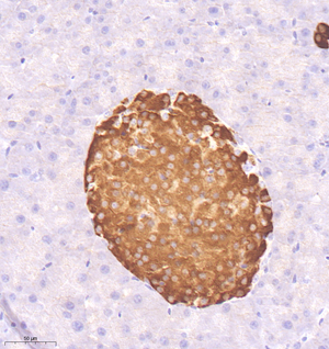 02 GB12336_20221116_insulin_1E4E9_1E4E9 20221008 M pancreas d1000_29.8x_IHC.jpg