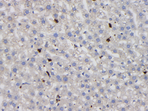 08 GB15397_20221123_S100A4_GB15397_GB15095221114 R liver d1000_40x_IHC.jpg