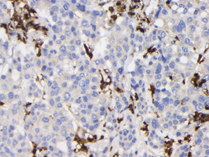 09 GB15397_20221123_S100A4_GB15397_GB15095221114 H liver d1000_40x_IHC.jpg