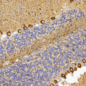 04 GB115066_20221010_ZDHHC17_13278_1327822042102 M cerebellum d600_20.0x_IHC.jpg