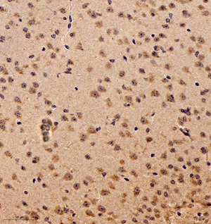 04 GB115084_20221010_RRBP1_13335_1333522042102 M brain d600_30.0x_IHC.jpg