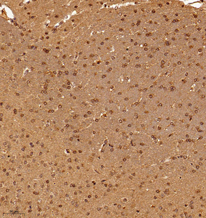 03 GB115086_20221010_VRK2_13339_1333922042102 R brain d600_20.0x_IHC.jpg