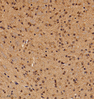 04 GB115086_20221010_VRK2_13339_1333922042102 M brain d600_30.0x_IHC.jpg