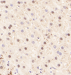 02 GB115090_20221122_CCNI2_13362_1336222042602 H liver d600_40.0x_IHC.jpg