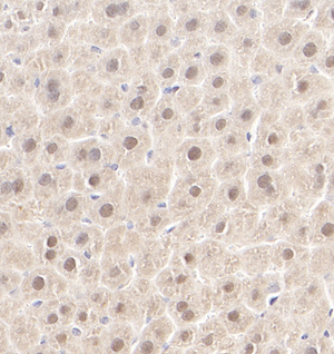 06 GB115090_20221122_CCNI2_13362_1336222042602 M liver d600_40.0x_IHC.jpg