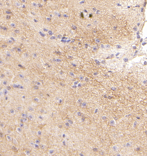 02 GB115109_20221122_GABA Transporter 3_13406_1340622042602 M Brain d600_40.0x_IHC.jpg