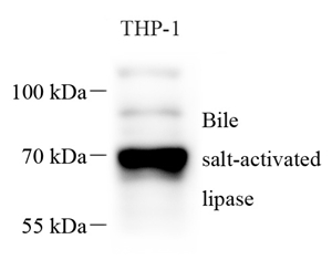 01 GB115262_13742 Bile salt-activated lipase_WB.jpg