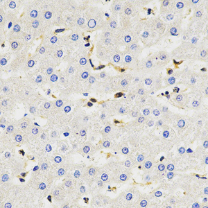 04 20221225_ASC_C2283_C228322071204 H liver d1800_40x_IHC.jpg