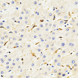 06 20221225_ASC_C2283_ C228322071204 H liver d600_40x_IHC.jpg