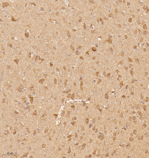 03 GB115186_20221225_KIF4A_13560_1356022052002 M Brain d700_20.0x_IHC.jpg