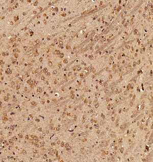 02 GB115200_20221226_B3GALNT1_13580_1358022052002 M Brain d700_20.0x_IHC.jpg