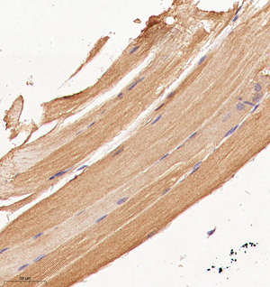 02 GB115204_20221226_SLC25A45_13589_1358922052002 M skeletal muscle d700_30.0x_IHC.jpg