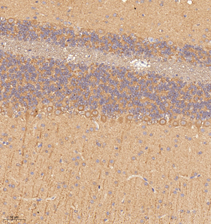 02 GB115209_20221226_NBEA_13596_1359622052002 M cerebellum d800_20.0x_IHC.jpg