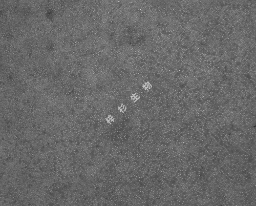 低密度.jpg