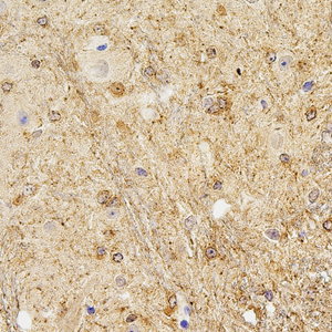 04 GB115303_20230201_Ermin_13779_1377922062402 M spinal marrow d800_40x_IHC.jpg