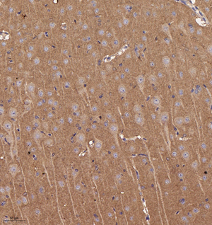 03  GB114993_20221010_AP3B2_13185_1318522032202 R brain d800_20.0x_IHC.jpg