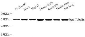 01 GB11017_beta-Tubulin_WB.jpg