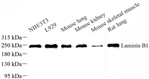 01 GB11408_1067 Laminin beta 1_WB(1).jpg