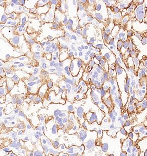 03 GB115319_20230110_CD109_C2771_C277122111503 M placenta d3000_40.0x_IHC.jpg