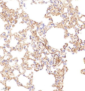 04 GB115319_20230110_CD109_C2771_C277122111503 M lung d3000_40.0x_IHC.jpg