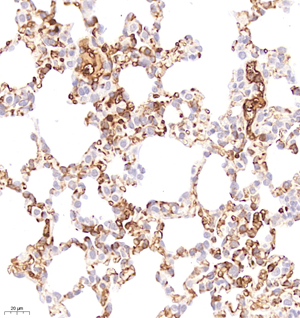 06 GB115319_20230110_CD109_C2771_C277122111503 R lung d3000_40.0x_IHC.jpg