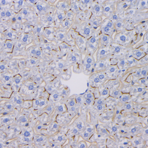 02 GB115320_20221225_CD26_C2732_C273222083002 M liver d300_40x_IHC.jpg