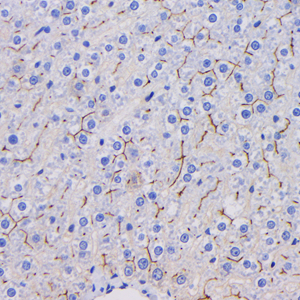 04 GB115320_20221225_CD26_C2732_C273222083002 R liver d300_40x_IHC.jpg
