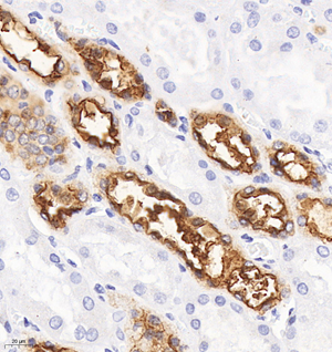 04 GB115321_20230110_CD227_C2347_C234722081602 H kidney d500_40.0x_IHC.jpg