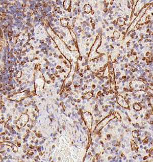 06 GB121308_20230214_vimentin_5D7F6_5D7F6 20221214 R spleen d1000_40.0x_IHC.jpg