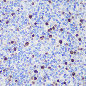 03 GB151141_20230216_ki67_C475_20230131 H tonsil d500_40x_IHC.jpg