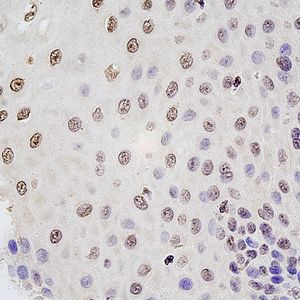 02 GB115332_20230214_CCDC28A_13862_1386222070802 H esophagus d1000_40x_IHC.jpg