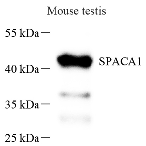 01 GB115333_13863 SPACA1_WB.jpg