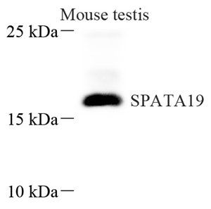 01 GB115376_14125 SPATA19_WB.jpg