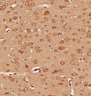 01 GB115363_20230126_KIAA0090_14060_1406022080102 R Brain d1000_IHC_25.0x.jpg