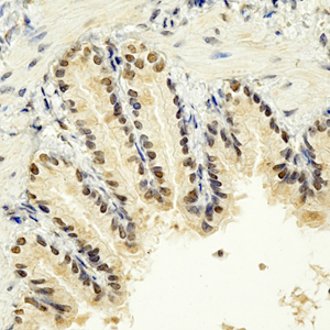 04 GB115337_20230214_FAM78B_13875_1387522070802 R lung d1000_40x_IHC.jpg