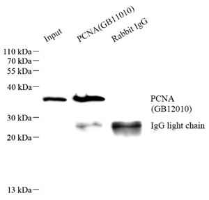 GB11010 PCNA_GB12010(TA)_IP.jpg