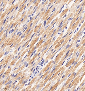 02 GB114229_20220329_JPH1_11908_1190821062902 RM skeletal muscle d2000_40.0x_IHC.jpg